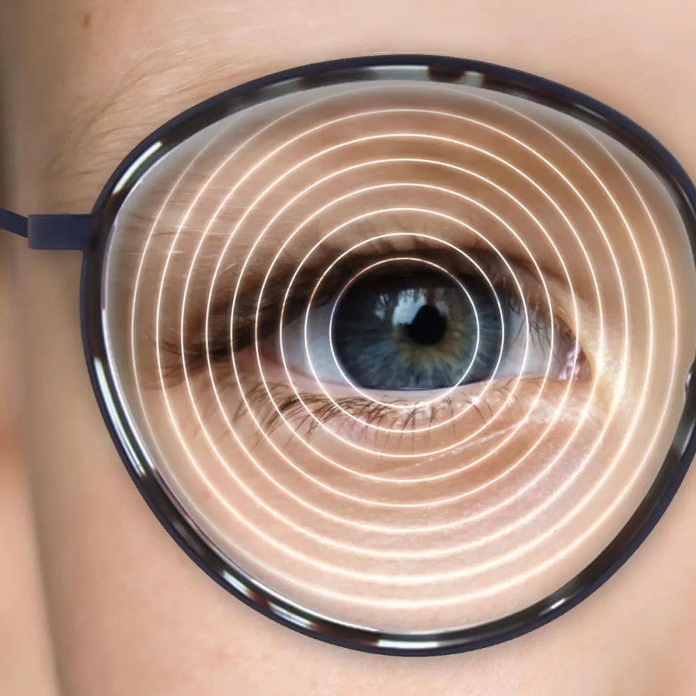 Myopia_control.jpeg-2 Myopia_control.jpeg-2